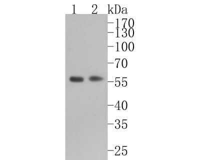 Western Blot: RXR alpha/NR2B1 Antibody (JG99-38) [NBP2-75653]