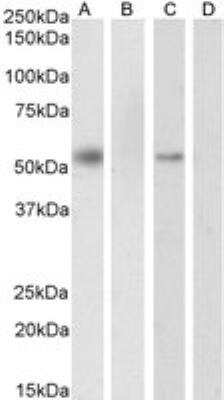 Western Blot: RXR alpha/NR2B1 Antibody [NB100-1466]