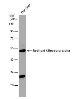 Western Blot: RXR alpha/NR2B1 Antibody [NBP2-20130]