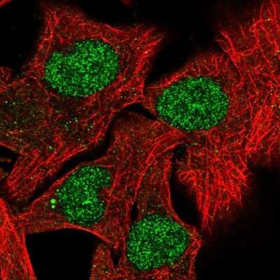 Immunocytochemistry/ Immunofluorescence: RXR beta/NR2B2 Antibody [NBP2-57755]