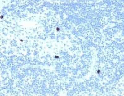 Immunohistochemistry-Paraffin: RXR beta/NR2B2 Antibody (PCRP-RXRB-2B6) - Azide and BSA Free [NBP3-08445]