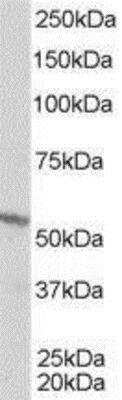 Western Blot: RXR beta/NR2B2 Antibody [NB100-1467]