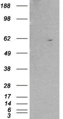 Western Blot: RXR beta/NR2B2 Antibody [NB100-1467]