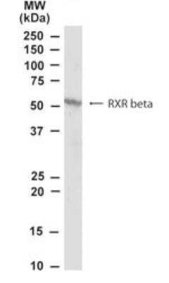 Western Blot: RXR beta/NR2B2 Antibody [NB100-1467]