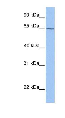 Western Blot: RXR beta/NR2B2 Antibody [NBP1-52812]