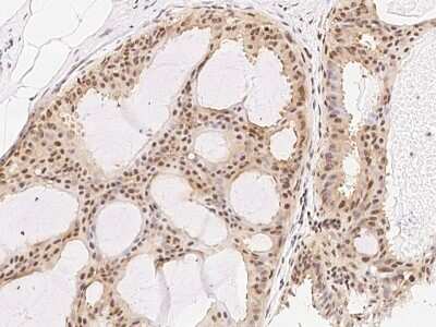 Immunohistochemistry-Paraffin: RXR gamma/NR2B3 Antibody [NBP2-98864]