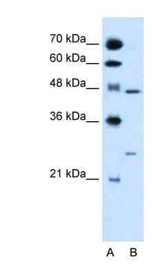 Western Blot: RXR gamma/NR2B3 Antibody [NBP1-52815]