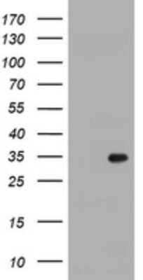 Western Blot: RYBP/DEDAF Antibody (OTI2B4) [NBP2-45967]