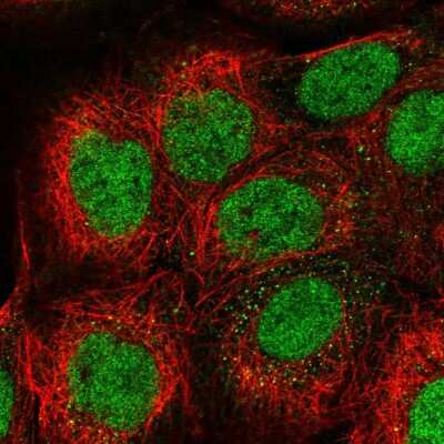 Immunocytochemistry/ Immunofluorescence: RYBP/DEDAF Antibody [NBP2-49083]