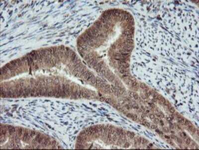 Immunohistochemistry: RYBP/DEDAF Antibody (OTI1B2) - Azide and BSA Free [NBP2-73961]