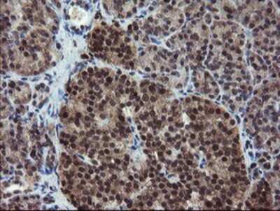 Immunohistochemistry: RYBP/DEDAF Antibody (OTI1B2) - Azide and BSA Free [NBP2-73961]