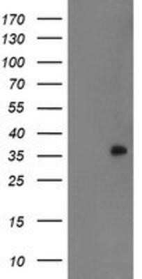 Western Blot: RYBP/DEDAF Antibody (OTI1B2)Azide and BSA Free [NBP2-73961]