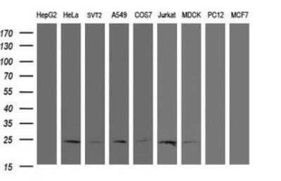 Western Blot: RYBP/DEDAF Antibody (OTI2B4)Azide and BSA Free [NBP2-73962]