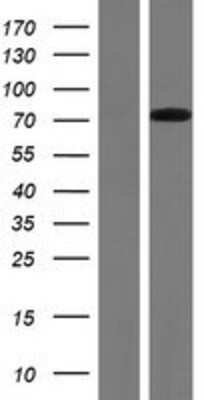 Western Blot: Ryk Overexpression Lysate [NBP2-08054]