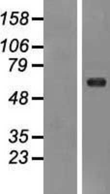 Western Blot: Ryk Overexpression Lysate [NBP2-09101]