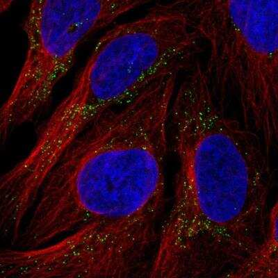 Immunocytochemistry/ Immunofluorescence: RYR3 Antibody [NBP2-76559]