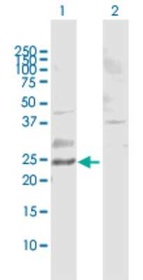 Western Blot: Rab11 Antibody [H00009230-B02P]