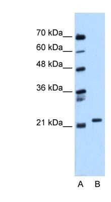 Western Blot: Rab11 Antibody [NBP1-58933]