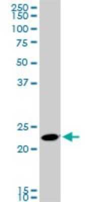 Western Blot: Rab11A Antibody (1F7-2A8) [H00008766-M01]