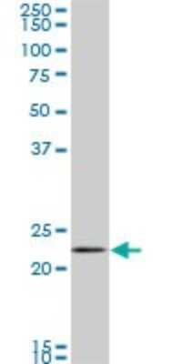 Western Blot: Rab11A Antibody (1F7-2A8) [H00008766-M01]