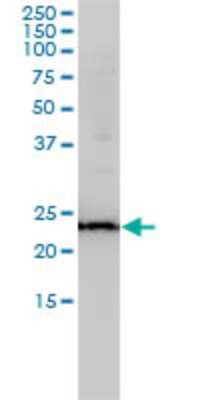 Western Blot: Rab11A Antibody (1F7-2A8) [H00008766-M01]