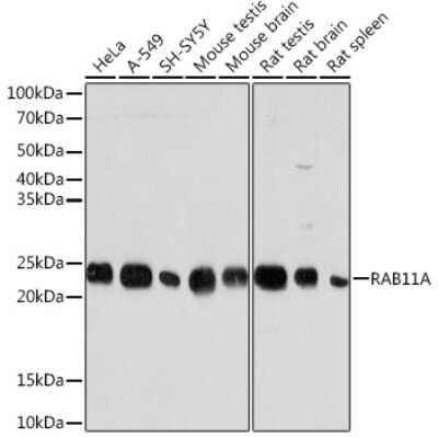 Western Blot: Rab11A Antibody (3O4R8) [NBP3-16160]