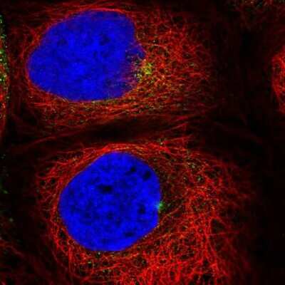 Immunocytochemistry/ Immunofluorescence: Rab11A Antibody [NBP2-68698]