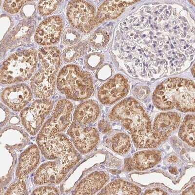 Immunohistochemistry-Paraffin: Rab11A Antibody [NBP2-49320]
