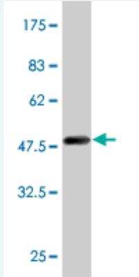 Western Blot: Rab11A Antibody (S1) [H00008766-M07]