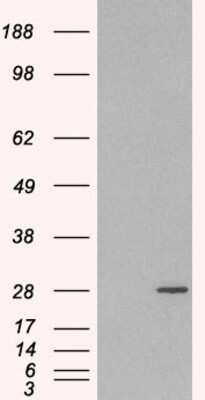 Western Blot: Rab11A Antibody [NB100-1086]