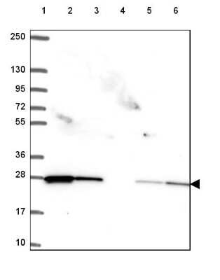 Western Blot: Rab11A Antibody [NBP2-49320]