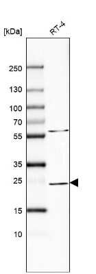 Western Blot: Rab11A Antibody [NBP2-68698]