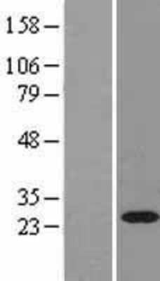 Western Blot: Rab11A Overexpression Lysate [NBL1-15038]