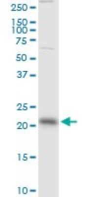 Western Blot: Rab13 Antibody (8H8) [H00005872-M01]