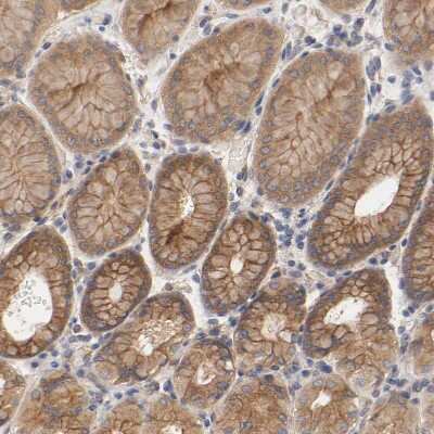 Immunohistochemistry-Paraffin: Rab13 Antibody [NBP1-85799]