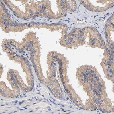 Immunohistochemistry-Paraffin: Rab13 Antibody [NBP1-85799]