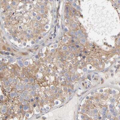 Immunohistochemistry-Paraffin: Rab13 Antibody [NBP1-85799]
