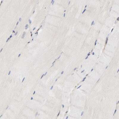 Immunohistochemistry-Paraffin: Rab13 Antibody [NBP1-85799]