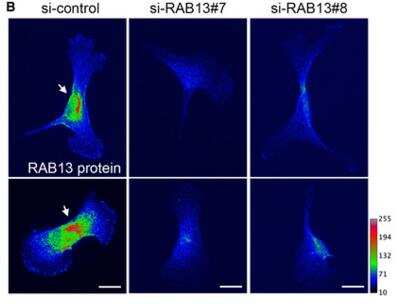 Knockdown Validated: Rab13 Antibody [NBP1-85799]