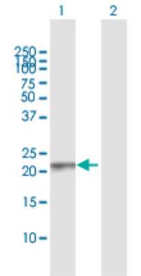 Western Blot: Rab13 Antibody [H00005872-D01P]