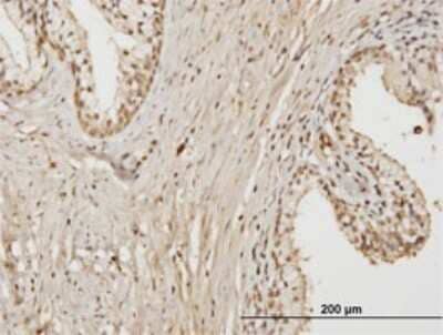 Immunohistochemistry-Paraffin: Rab17 Antibody (2A10) [H00064284-M01]