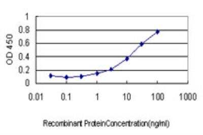 ELISA: Rab17 Antibody (2B7) [H00064284-M05]