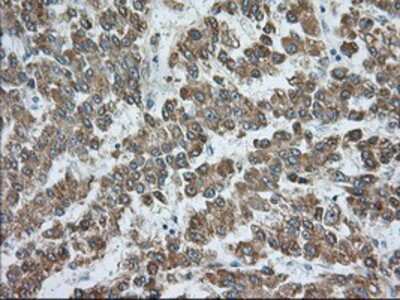 Immunohistochemistry-Paraffin: Rab17 Antibody (OTI5E2) [NBP2-02599]