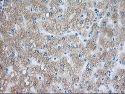 Immunohistochemistry-Paraffin: Rab17 Antibody (OTI5E2) [NBP2-02599]