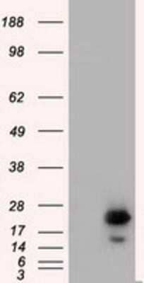 Western Blot: Rab17 Antibody (OTI5E2) [NBP2-02599]