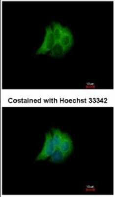Immunocytochemistry/ Immunofluorescence: Rab17 Antibody [NBP2-20036]