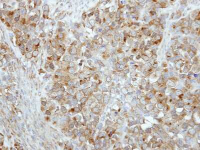 Immunohistochemistry-Paraffin: Rab17 Antibody [NBP2-20036]