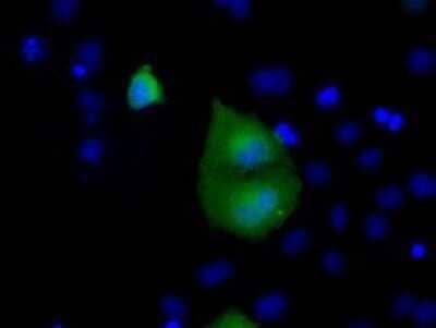 Immunocytochemistry/ Immunofluorescence: Rab17 Antibody (OTI5E2) - Azide and BSA Free [NBP2-73765]