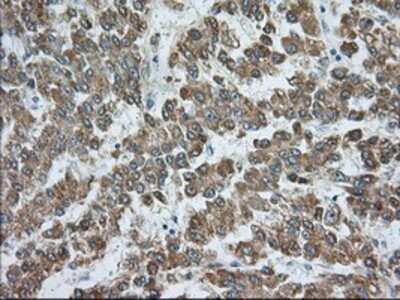 Immunohistochemistry: Rab17 Antibody (OTI5E2) - Azide and BSA Free [NBP2-73765]