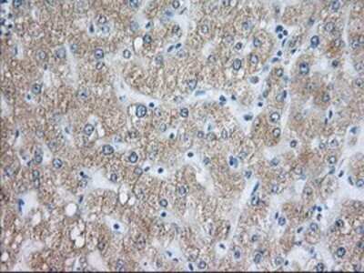 Immunohistochemistry: Rab17 Antibody (OTI5E2) - Azide and BSA Free [NBP2-73765]